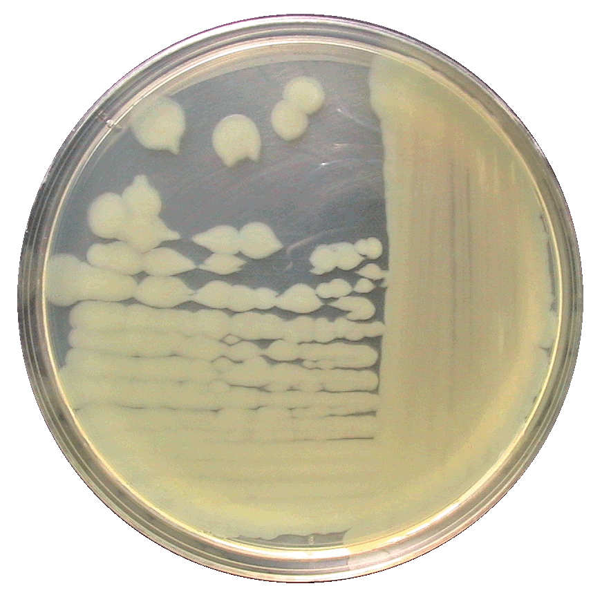 Alginolyticus on TSA